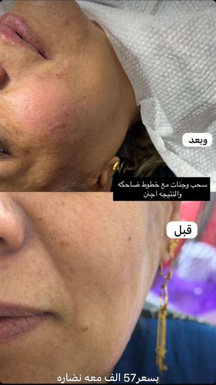 العنوان بغداد جسر ديالى القديم شارع 60 قرب معهد الزهراء النموذجي او جامع رسول سنتر رزان التجميل رقم الواتساب ***********
