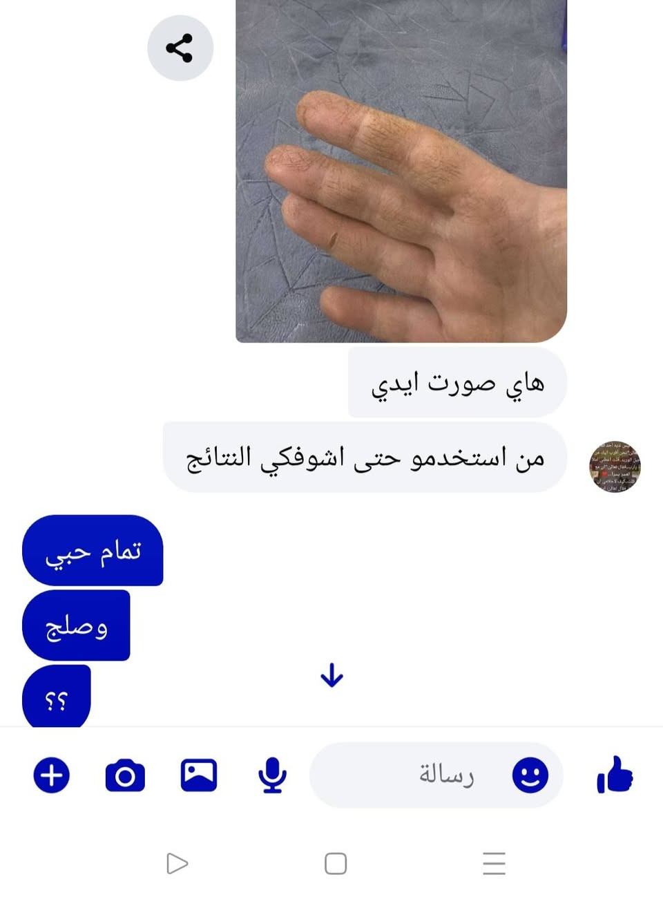 #علاج #الأكزيما #والتشقق #والخشونة #بالأيد #والقدم #والجسم #متوفر #وبفضل #الله #نتائجة #تسعد #القلب 
#بكج #متكون #من #صابونة  #ومرهم #علااجي #لكل #الي #ذكرتة ✅❤️‍🔥👇


**إذا كنت صاحب هذا الإعلان وتريد حذفه لأي سبب، رجاءا أرسل رسالة إلى الدعم الفني**