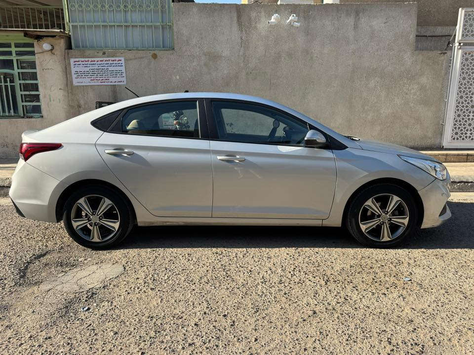 السلام عليكم
اكسنت خليجي 2018  - شكل ال19
مانع انزلاق
اشاير بالمري
حساسات
كاميرا خلفية اني شادها
تايرات باتري جدد
ماشية 199,600 كم
بيها بارد

السنوية جديدة ورقم جديد


**إذا كنت صاحب هذا الإعلان وتريد حذفه لأي سبب، رجاءا أرسل رسالة إلى الدعم الفني**