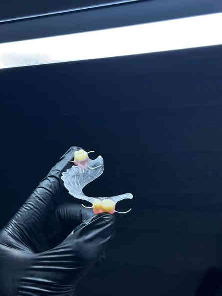 السلام عليكم منو محتاج طقم تركيب جزئي الاسنانه ، عيادات جامعة العميد وفرت طقم اسنان تركيب جزئي للاسنان والعلاج يكون مجاني وبأشراف اطباء مختصين وكل الهلا بيكم🤍
للتواصل راسلونا على الواتساب لتثبيت الموعد  ➞ ***********
