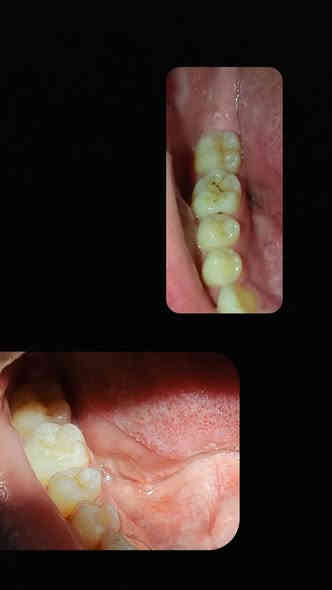 سلام عليكم 
تعلن عيادات جامعة الكفيل التابعة للعتبة العباسية عن أستقبال الحالات التالية:

_حشوات ضوئية .. حشوات بلاتين
_قلع للأسنان والجذور المتبقيه
_تنظيف الأسنان من التكلسات
_تعويض الأسنان بطقم جزئي( للشخص الفاقد جزء من اسنانه) 

🎈 علماً أن العلاج مجاني بالكامل 
الي عندة من الحالات المذكورة التواصل ع الرقم 
***********

العنوان : عيادات الكفيل .. النجف الأشرف .. شارع الاسكان .. مجاور مستشفى الزهراء

