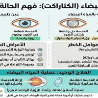 عيادة د.احمد الرديني اختصاص طب وجراحة العيون والليزر للحجز 07759386265...