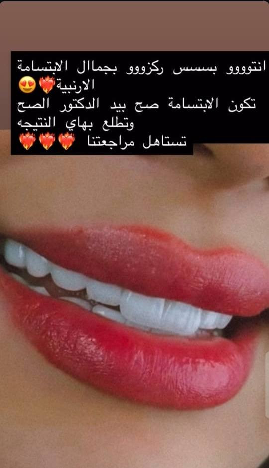 تعلن عيادات إبرو لطب الاسنان وتجميل عن عروض وتخفيضات في قسم الأسنان والتجميل مكانه  ماجديه نهاية شارع الجامع مقابيل مأكولات البيك ***********
