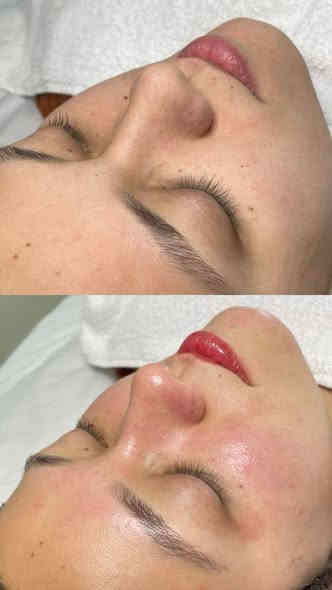 اهلا وسهلا زبوناتنا الجميلات رضائكم هو غايتنا ولتكوني مميزه 🎀
اسعارناً مناسباً 📍✨
تنظيف البشرة هايدرو ب15
تنظيف البشرة ملكي ب25
حفافة 5
شمع للوجه  8
بديكير 10 مع املاح طبيعية 
الماكير 20
سحب لون شعر قصير 20 واسط 25 فما فوق حسب طول الشعر
صبغ شعر قصير جدا 15 المتن 25 الوسط 35 الطويل حسب طول الشعر 
ميش كثيف قصير 25 فما فوق حسب طول الشعر
تسريح الشعر يخلي شعرج سرح حسب طول الشعر 
قص 5 اي قصه 
معالج لترميم وتغذية الشعر القصير 30 فما فوق حسب طول الشعر
اهلا وسهلا بلجميع 
مركز ألين للتجميل
العنوان//كربلاء حي الرباب قرب سيد سماعيل 
الحجز //***********
***********
