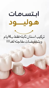 تركيب اسنان • غلق الفراغات • الموصل المصارف