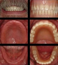 تعويض أسنان • مجاني • سريع القادسية