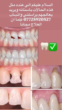 ✨ عرض خاص للحشوات التجميلية – مجانــاً ليوم غد الســبت فقط! ✨ لمن يعان...