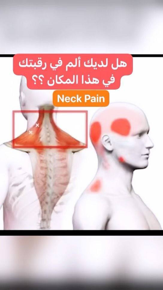 ⚠️ ضغط الأعصاب في الرقبة

الكثير من الأشخاص يعانون من ألم في الرقبة أو تنميل في اليدين دون معرفة السبب الحقيقي، وقد يكون ذلك نتيجة ضغط على الأعصاب في الرقبة بسبب مشاكل في الفقرات أو الجلوس لفترات طويلة.

🧠 أهم الأعراض التي قد تظهر:

• ألم في الرقبة يمتد إلى الكتف أو الذراع
• تنميل أو وخز في اليدين أو الأصابع
• ضعف في عضلات الذراع
• صداع متكرر يبدأ من الرقبة
• صعوبة في تحريك الرقبة أحيانًا

اكثر المراجعين من ايصيبهم وثاب يستخدمون طك الوثاب وهذا ابد موصحيح لان سبب الرئيسي هو تشنج اوضغط الفقرات العنقيه على عصب ويسبب الم الكتاف صداع نصفي صداع مزعج 

نخلصك كل من هذا الم بالتشخيص الصحيح 
كل ما عليك اتصل او راسلني وات ساب 
يتوفر لدينا اجهزة حديثه 

⚠️ انتبه:
إهمال هذه الأعراض قد يؤدي إلى زيادة الألم أو ضعف الأعصاب مع الوقت.

💡 نصيحة:
الحفاظ على وضعية جلوس صحيحة وممارسة التمارين الخفيفة قد يساعد في تقليل الضغط على الأعصاب.

المعالج عمار الدليمي 
*********** وات ساب
*********** وات ساب

#الأعصاب
#ضغط_الأعصاب
#آلام_الرقبة
#الفقرات
#تنميل_اليدين
