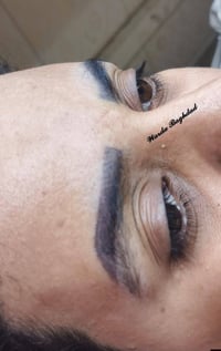 من اول جلسه شفنه النتيجه وانشالله الجلسه الثانيه يرجع طبيعي والحمدالله...