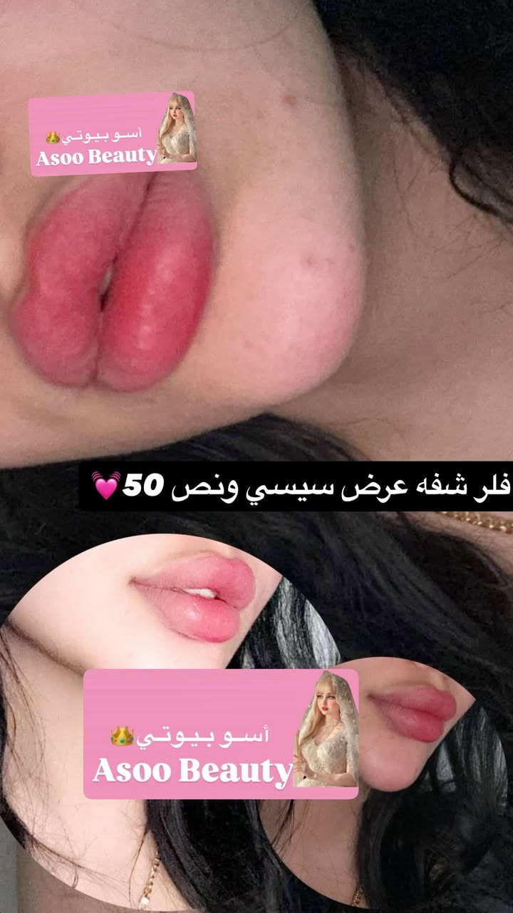 مركز وصالون أسو بيوتي جزء من شغلي العنوان اركيه وفاضل يم أسواق بركات المصطفى مركز وصالون أسو بيوتي متواجدين من الساعه 12 الظهر إلى 11بليل ❣️❣️💅🏻


**إذا كنت صاحب هذا الإعلان وتريد حذفه لأي سبب، رجاءا أرسل رسالة إلى الدعم الفني**