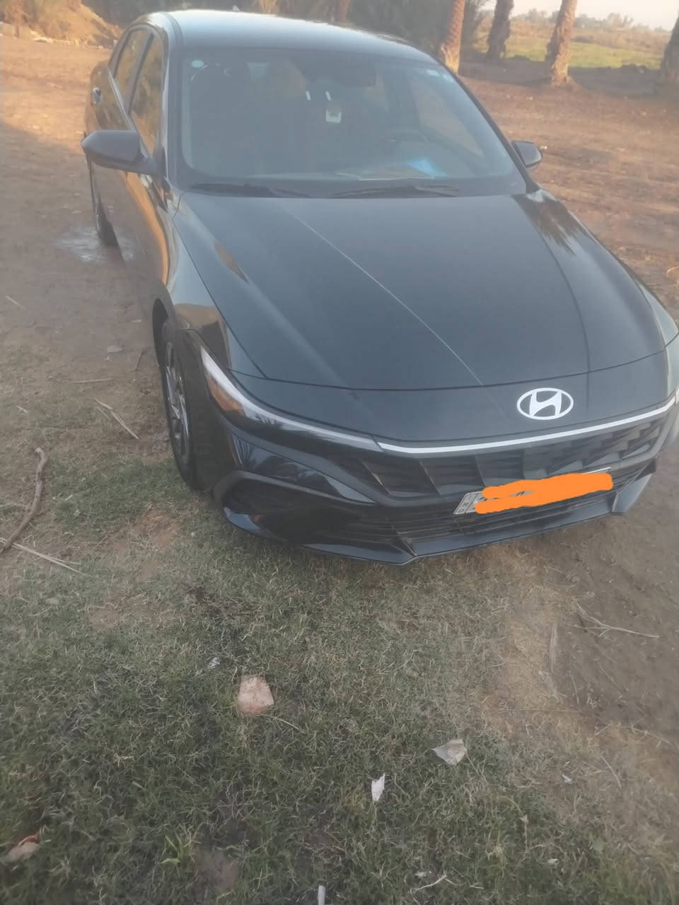 النترا ٢٤ مكفوله كفاله عامه البيع او مراوس اوبتيما ١٠ المعلومات الاتصال على الرقم ***********
