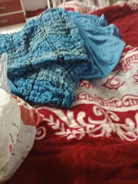 تلبيسة تخم • ١٠قفل