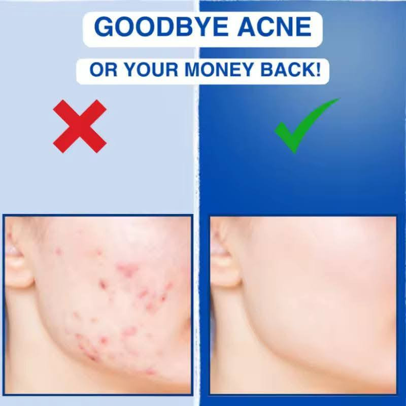 عصا علاج بشرة الوجه عالية التردد جهاز تجميل الوجهه المحمول للعناية بالجعد وشد الجلد وتقليل تجاعيد حب الشباب
الاستخدام: يستخدم لعلاج حب الشباب، تقليل الالتهابات، تحفيز إنتاج الكولاجين، وتقليل الخطوط الدقيقة 
ع اول تم 15


**إذا كنت صاحب هذا الإعلان وتريد حذفه لأي سبب، رجاءا أرسل رسالة إلى الدعم الفني**