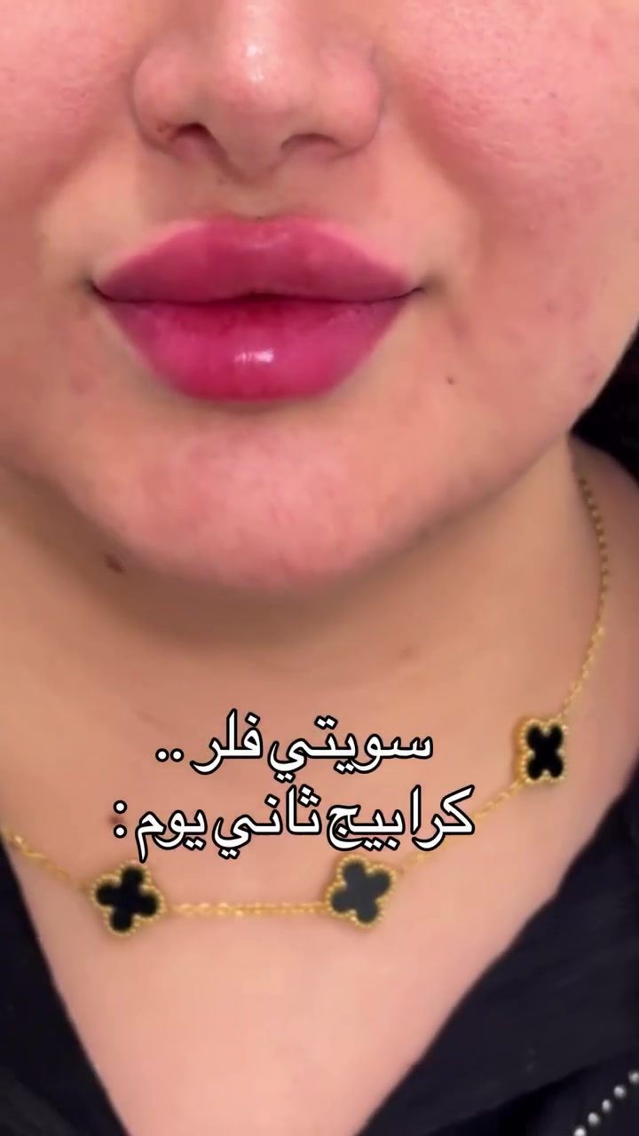هلاو بنات شلونكم هذا شغل مركز عنواني بغداد حي اور تواصل والحجز *********** ادخلو ع حساب انستا شوفو بقيه الشغل
