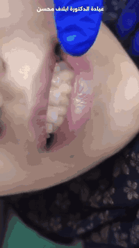 حشوات ضوئية • د. إيلاف محسن • المدائن شارع الأطباء