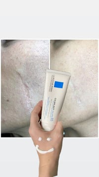 مرمم سكا بلاست • لاروش الفرنسية • بشرة حساسة