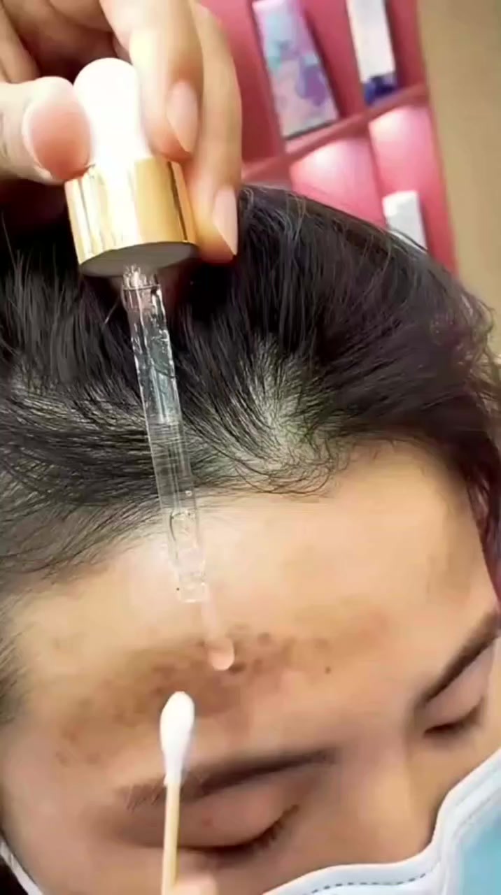 ✨🌙 سرّ البشرة الشابة يبدأ بسيروم الريتنول من فوريفر! 🌙✨
مع سيروم الريتنول من فوريفر 💛
امنحي بشرتك عناية متقدمة ولمسة تجديد فاخرة 🌿
💎 يساعد على تقليل مظهر الخطوط الرفيعة
💎 يدعم تجديد خلايا البشرة
💎 يمنح نعومة وإشراقة ملحوظة
💎 يحسّن ملمس البشرة ومظهرها العام
مثالي للاستخدام الليلي 🌙
ليعمل على تجديد بشرتك أثناء النوم ✨ #عناية متكامله #شركة @إشارة


**إذا كنت صاحب هذا الإعلان وتريد حذفه لأي سبب، رجاءا أرسل رسالة إلى الدعم الفني**