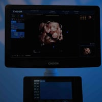 🔷 جهاز Chison CBit 4 — خيار الأطباء الأذكى للتشخيص الدقيق ..  ✨ عندما ...