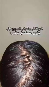 زيت الافغاني • يوقف التساقط • يثخن ويطول