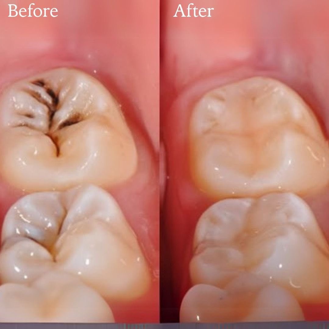 العلاج مجاني


**إذا كنت صاحب هذا الإعلان وتريد حذفه لأي سبب، رجاءا أرسل رسالة إلى الدعم الفني**