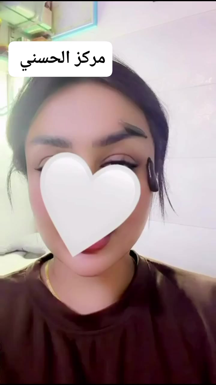 🌟 مركز الحسني: نافذة جديدة للأمل والشفاء 🌟
​هل تعاني من مشاكل في أعصاب العين أو تبحث عن حلول فعالة للأمراض المستعصية؟ نحن في مركز الحسني نجمع بين الخبرة العلمية والتقنيات العلاجية الطبيعية لنقدم لكم أفضل النتائج.
​✅ تخصصنا في علاج:
​تلف أعصاب العين: تحفيز التروية الدموية وتنشيط الأعصاب المتضررة.
​الصداع المزمن والشقيقة: تخفيف الضغط والالتهابات بشكل طبيعي.
​مشاكل الدورة الدموية: باستخدام "العلق الطبي" المعروف بقدرته الفريدة على سحب السموم وضخ إنزيمات حيوية في الجسم.
​الأمراض الجلدية والمناعية: برامج علاجية مخصصة لكل حالة.
​🔬 لماذا تختار مركز الحسني؟
​نحن نعتمد العلاج بالعلق الطبي (Hirudotherapy) تحت إشراف متخصصين، حيث تعمل هذه الكائنات الدقيقة على:
​تحسين تدفق الدم في الأوعية الدقيقة للعين.
​تقليل التورم والالتهابات العصبية.
​تنشيط الخلايا للتعافي الذاتي.
​"صحتكم هي أغلى ما تملكون.. وثقتكم هي سر نجاحنا."
​الحجز ***********
​#مركز_الحسني #علاج_طبيعي #تلف_أعصاب_العين #العلق_الطبي #صحة_العين #طب_بديل #شفاء
