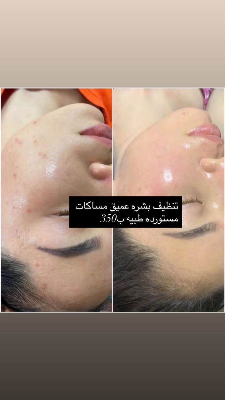 العروض موجوده من النهارده تعالو ف اي وقت اعملوها♥️♥️
للتواصل @ [153***********65:13708:010 12147454]
