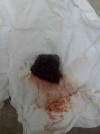 حجر هبهاب نازف للبيع الاتصال على رقم 07759808039