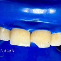 بسمايه • الشارع العام • حجز واتساب