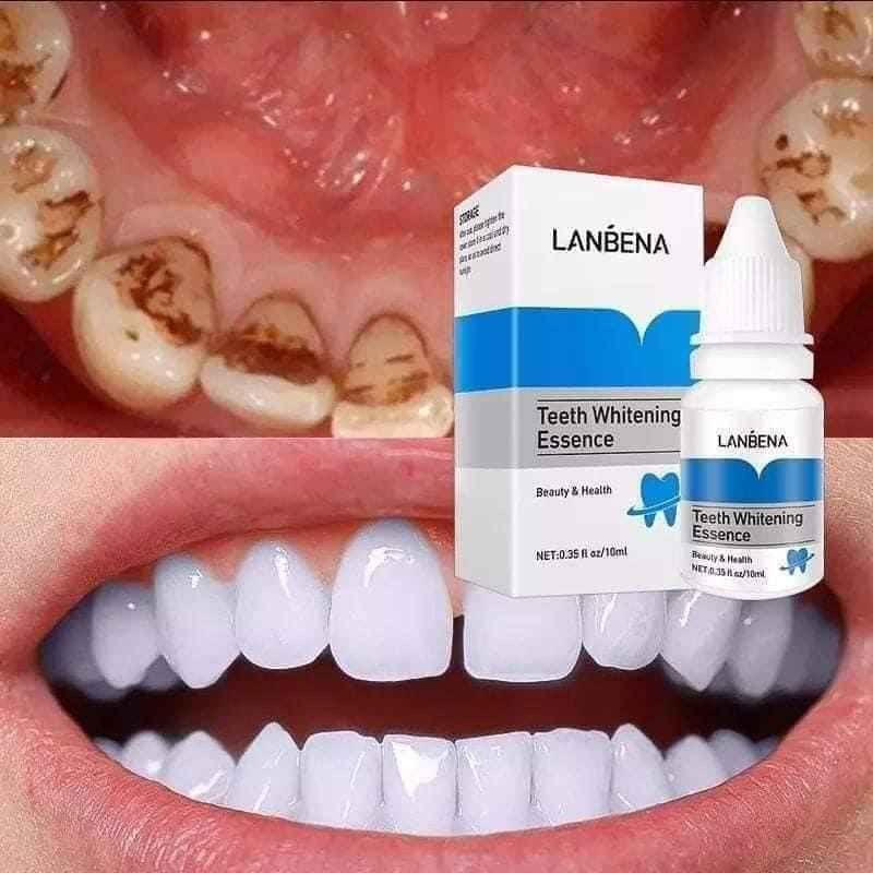 قطرات تبييض الاسنان من   Lanben
 الي يعاني من صفار أسنانه او البقع من كثرة التدخين او شرب الشاي والقهوة والمواد الصبغية 
وحاب يرجع اسنانه بيض انصحك بأستخدم منتج لانبينا للتبييض الأسنان ومن اول استعمال
أسرع مبيض اسنان على الإطلاق يزيل الاصفرار 
❤رجع لمعان ابتسامتك بلحظات  
❤مضمون 100%
السعر خاص بغداد, العراق


**إذا كنت صاحب هذا الإعلان وتريد حذفه لأي سبب، رجاءا أرسل رسالة إلى الدعم الفني**