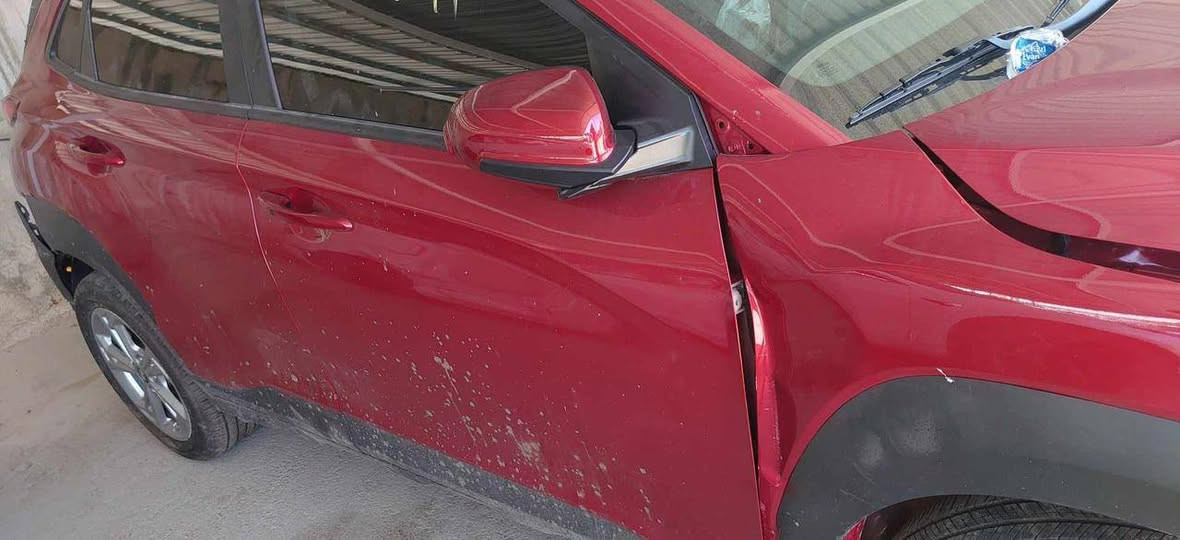 هيونداي كونا 2023 – مكينة 2000 – AWD – عداد 22،000 ميل
🔹 النوع: هيونداي كونا

🔹 الموديل: 2023

🔹 المحرك: 2.0 لتر / MPI

🔹 الدفع: دفع رباعي AWD

🔹 ناقل الحركة: أوتماتيك cvt

🔹 العداد: 22,000 ميل فقط

🔹 اللون: (احمر) 

المواصفات:

 • محرك 2000 ناعم واقتصادي DUCH

 • شاشة وسطية

 • كاميرا خلفية + حساسات

 • كروز كنترول

 • ستيرن تحكم

 • أنوار LED

 • ايرباك السائق طاك

 • مانع انزلاق ABS

 • نظام توازن إلكتروني ESC

 • وضعيات قيادة

.اوتو ستوب  

اشاير بالمري 

الحالة:

 • السيارة نظيفة جداً

 • استخدام خفيف

 • الداخل والخارج مثل الجديد

 • ما تحتاج أي مصرف

 • 

السعر:

167$

السعر قابل للتفاوض للجاد

رقم الهاتف ***********

موقع بغداد الزعفرانية📍
