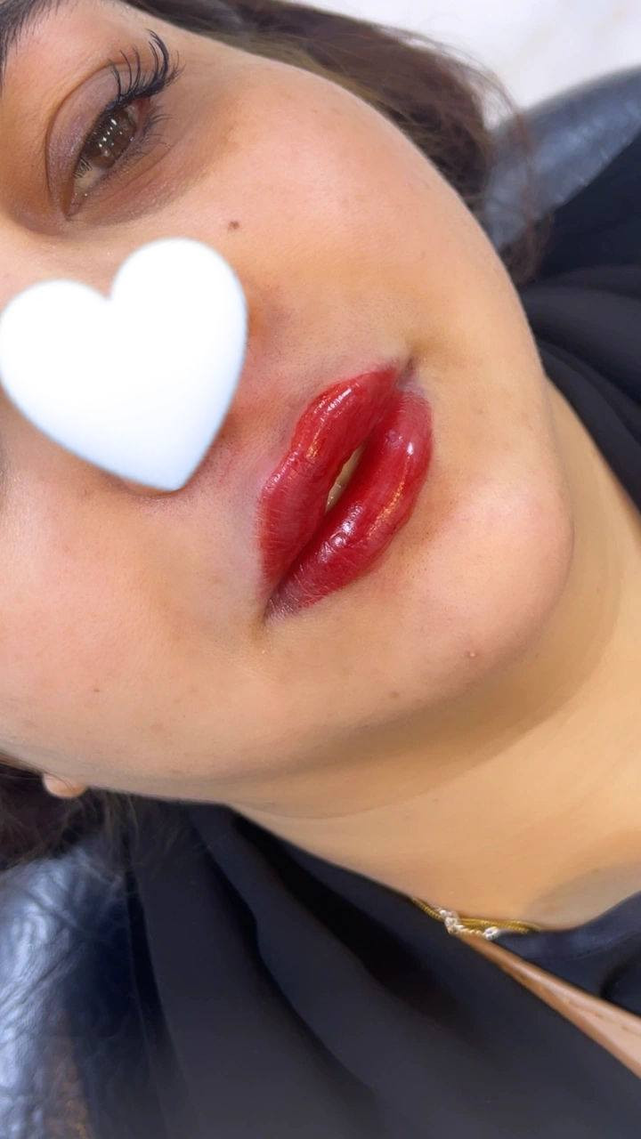 استقبلي العيد بهيج جمال شفة 
 قبل وبعد الحقن مستمرين بالعروض كيكاتي 🤭 
عروض كل هذا جمال 50


**إذا كنت صاحب هذا الإعلان وتريد حذفه لأي سبب، رجاءا أرسل رسالة إلى الدعم الفني**