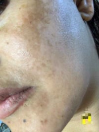 بكج فرنسي • كلف عميق • تفتيح ونضارة