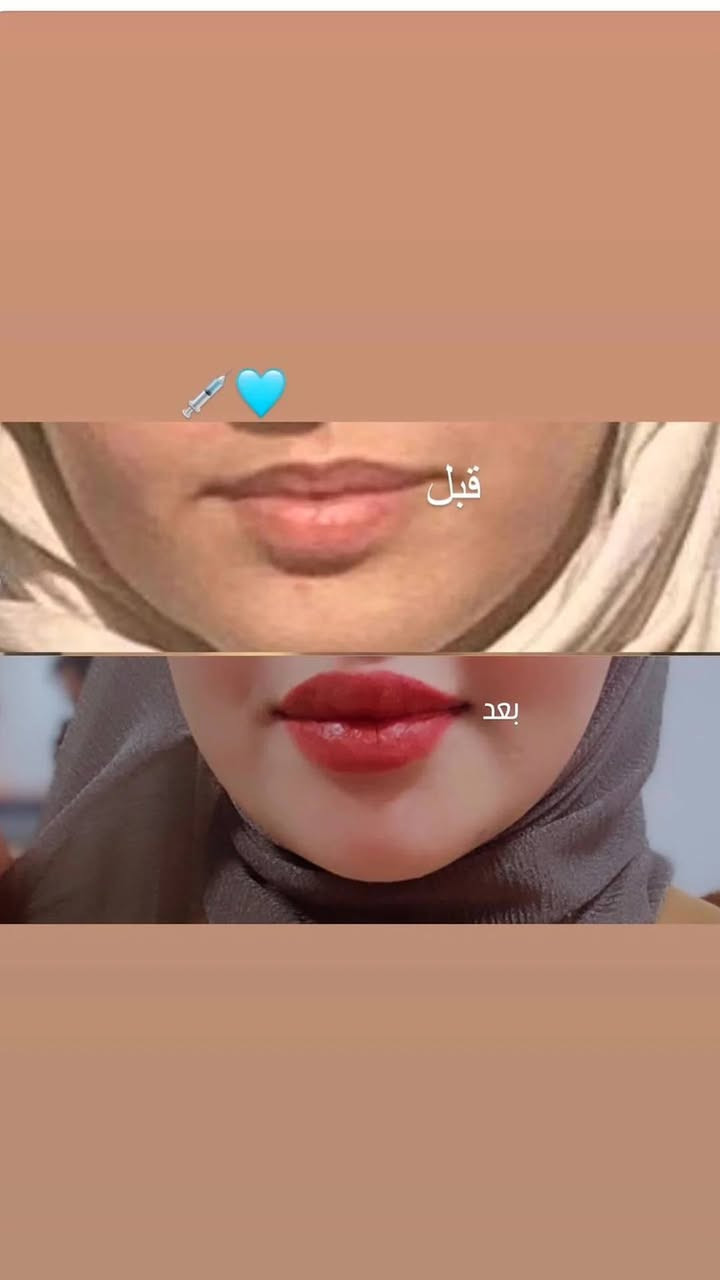 الحجز خاص 😍


**إذا كنت صاحب هذا الإعلان وتريد حذفه لأي سبب، رجاءا أرسل رسالة إلى الدعم الفني**