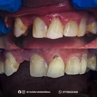 مجانا • حشوات تجميلية • كربلاء