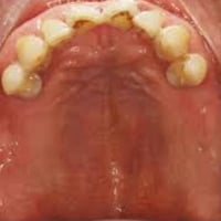 الي فاقد اسنان تشبه الحالات البصور يراسلني واتساب 07734280577 العنوان ...