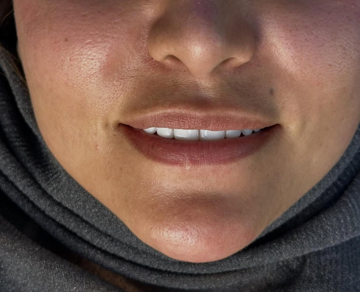 #فيلر


**إذا كنت صاحب هذا الإعلان وتريد حذفه لأي سبب، رجاءا أرسل رسالة إلى الدعم الفني**