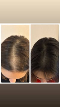 بخاخ شعر • شعر رمادي • مكونات عشبية