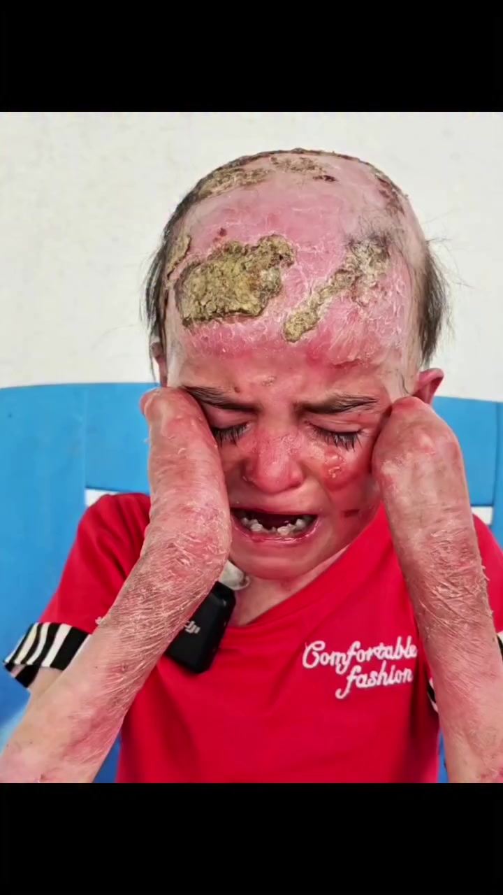 زكاة الفطر هي صدقة واجبة على كل مسلم (ذكر، أنثى، صغير، كبير) يملك قوت يومه تُخرج في نهاية رمضان وقبل صلاة العيد (ويجوز تعجيلها بيوم أو يومين) طُهرة للصائم ومواساة للفقراء. مقدارها حوالي (ألفين دينار عراقي لدى المذهب الشعي)و(ثلاث الاف دينار عراقي لدى المذهب السني)ويجوز إخراج قيمتها نقدًا 
سبعمائة واحد عشر طفل تحت رعاية مبادرتنا مبادرة الحياة للجميع 
نسعى إلى تقليل الأضرار لهؤلاء الأطفال الذين يعانون من أمراض داء الفقاع الجلدي وتحسين دور حياتهم وتوفير الحياة الكريمة لهم.
⭕لتسليم الزكاء حصراً التواصل عبر الخاص او رقم الواتساب 
***********
للمساهمة والتبرع لهم عبر المنافذ الاتية:
1️⃣تحويل الرصيد اسياسيل 
***********
2️⃣لتحويل الزين كاش
***********
3️⃣ماستر كارد الرافدين
تحويل ماستركارد 7947587882
تحويل سوبركي ***********

PayPal4️⃣
asal1994asal@yahoo.com

5️⃣للتحويل عبر مصرف العراق الاولfib
اوفيست باي او اسيا باي اوطيف باي
 عبر الرقم ***********
للتواصل عبر الواتساب 
***********
6️⃣كذالك تكَدرون تساهمون عن طريق ارسال صورة رصيد نوع اسيا عبر الخاص.

7️⃣وللتبرع من خارج العراق رابط منصة الكوفاندمي مثبت في بايو الحسابي.
⭕الخاص مفتوح الأسئلة والاستفسارات جميعاً

📌ارجوا مشاركة المنشور على صفحاتكم المحترمة كي يصل الى اكثر عدد ممكن وجزاكم اللّٰه اجر ناقذها.

#شارك_المنشور
#العراق #بغداد #اكسبلور #تصميمي iraq
