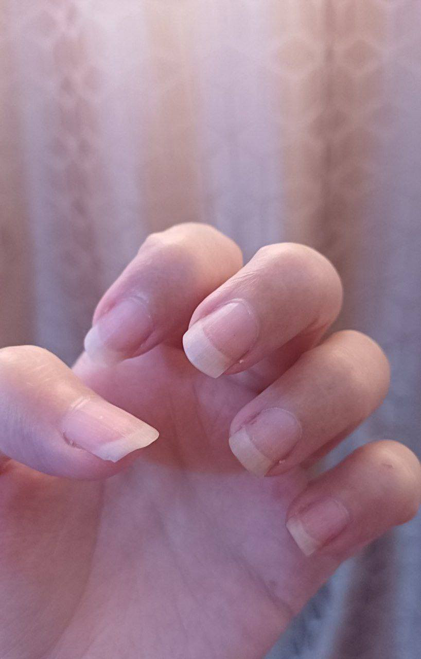 ‎مقوي اضافر Mavala💅 💅
اقوى و افضل مقوي اضافر ❤️‍🔥🔥
‎ طرف الظفر هو اكثر هشاشه والاقل حمايه والذي ينكسر بسهوله 💔🤦‍♂️😔
‎مقوي مافالا يقوي الاضافر المتضرره والتي تتكسر بسهوله😍😍 يتميز هذا المنتج بتركيبه خاصه ويقوي الاضافر من الانكسار💝😍💅💅
‎طريقه. الاستخدام:ازيلي ظلاء الاضافر او اي ظلاء اخر ونظفي الظفر بعنايه ابدائي بظلاء الظفر.

‎ ✅ يستخدم مرتين اسبوعيآ.

قطعة 15
تـــــــوصيــــــ🚗ــل بغـــــداد 4 محــافظات 6


**إذا كنت صاحب هذا الإعلان وتريد حذفه لأي سبب، رجاءا أرسل رسالة إلى الدعم الفني**