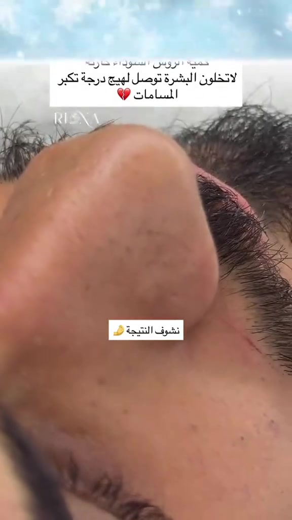 عياده النور لطب الأسنان وتجميل


**إذا كنت صاحب هذا الإعلان وتريد حذفه لأي سبب، رجاءا أرسل رسالة إلى الدعم الفني**