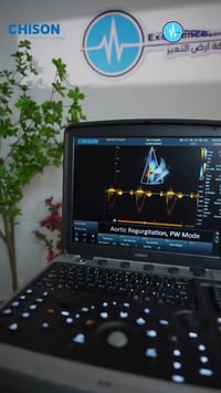 🤩 عرض SonoBook من CHISON 💥 و اقترب منتصف شهر الخير و ارض التميز معكم ب...