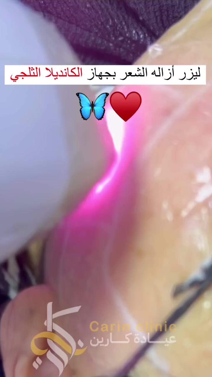 • قسم الليزر في مركزنا 🔥❤️
• جهاز الكانديلا الثلجي ❄️
• الحمزة الشرقي / شارع الاطباء / قرب عيادة دكتور مهند الميالي / مجاور صيدلية الايمن 
#للحجز والاستفسار مراسلة الصفحة او على الواتساب 
***********
***********
