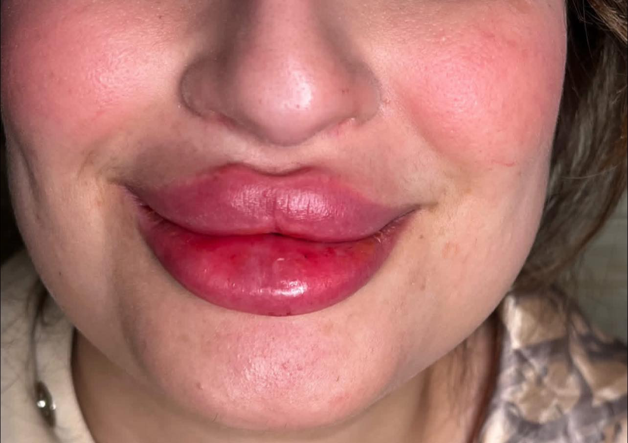 وياكم اخصائية حقن وتاتو زهراء جزء من شغلي اطلع خدمه منزليه داخل وخارج بسمايه للحجز اتصال او رسالة وتساب ***********
