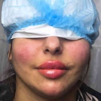 مركز اوتار كلنك • تجميل أسنان • الشموخ خلف الحنين