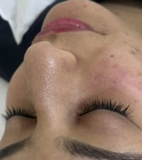 العيد قرب وبعدچ محتارة 🤔  تنضيف بشرة عميق جداً ✔️ باحدث الأجهزة ✔️ كل ...