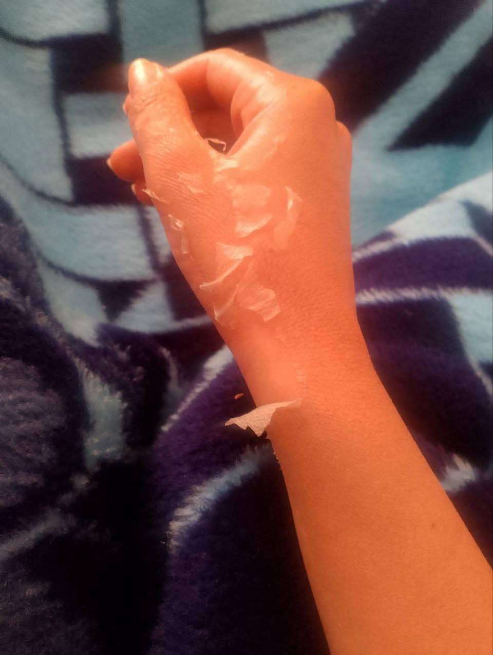 هلو بنات اخذت مقشر من كوزمتك بيتي
ولصراحه جنت ممصدكه اكو هيج تقشير وكتلها اذا فعلا تقشر وحصلت نتيجه اكول لكل بنات وانشر
وشخص يستمر وياكم لنهايه تقشير 
راح اشوفكم نتيجه وانتو شوفو فرق
والبنيه تستمر وياكم لنهايه تقشير 
ومسوين خصم هسه وباثي عدها قطع قليله خصوصي مخطوبات ووع باب زواج
بيتي كوزمتك


**إذا كنت صاحب هذا الإعلان وتريد حذفه لأي سبب، رجاءا أرسل رسالة إلى الدعم الفني**