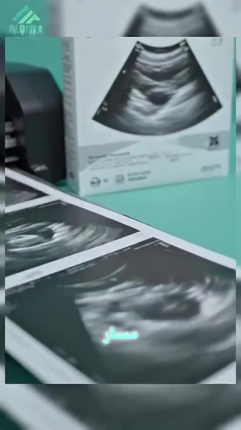 #sony
#Ultrasound_paper

الى اطباء الاشعة و السونار توفر ورق سونار سوني ياباني الاصلي  في #شركة_القمة_للاجهزة_والمستلزمات_الطبية

يتوفر بنوعية ورق High glossy و Normal

للأستفسار يرجى مراسلة الصفحة او الاتصال على الارقام التالية :-

📲***********
+964 782 233 2083

م.علا الحمداني 
د.مهتدي
