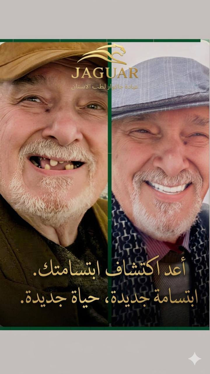 عياده جاكوار للاسنان
عنوانه الحارثيه خلف مستشفى الاميرات 
(قلع - حشوات - تنظيف - تقويم - زراعه ـ تبييض ـ ابتسامه المشاهير ـ جسور ثابته ـ ) 
للاستفسار اتواصلوا واتساب 
***********
