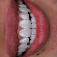 عناية أسنان • ابتسامة • البصرة المطيحه