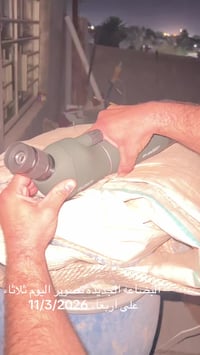 تلسكوب احترافي • ضد الضباب • مزاد